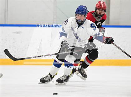 Thumbnail 3 in Conard @ Southington/Coginchaug/Westbrook photogallery.