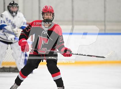 Thumbnail 3 in Conard @ Southington/Coginchaug/Westbrook photogallery.