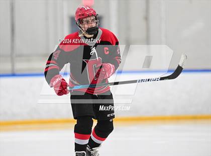 Thumbnail 2 in Conard @ Southington/Coginchaug/Westbrook photogallery.