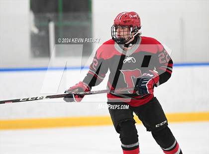 Thumbnail 2 in Conard @ Southington/Coginchaug/Westbrook photogallery.
