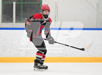 Thumbnail 2 in Conard @ Southington/Coginchaug/Westbrook photogallery.