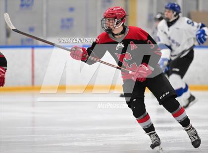 Thumbnail 1 in Conard @ Southington/Coginchaug/Westbrook photogallery.