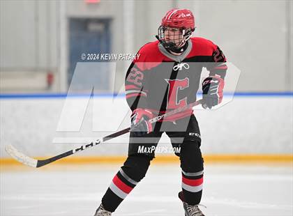 Thumbnail 2 in Conard @ Southington/Coginchaug/Westbrook photogallery.