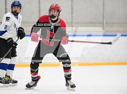 Thumbnail 1 in Conard @ Southington/Coginchaug/Westbrook photogallery.