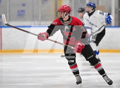 Thumbnail 2 in Conard @ Southington/Coginchaug/Westbrook photogallery.