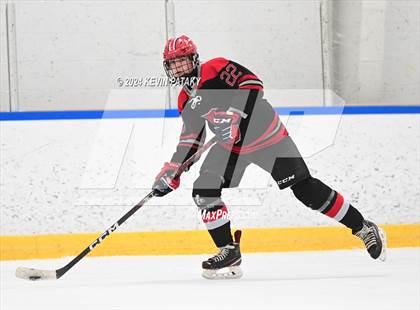 Thumbnail 1 in Conard @ Southington/Coginchaug/Westbrook photogallery.