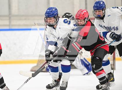 Thumbnail 3 in Conard @ Southington/Coginchaug/Westbrook photogallery.