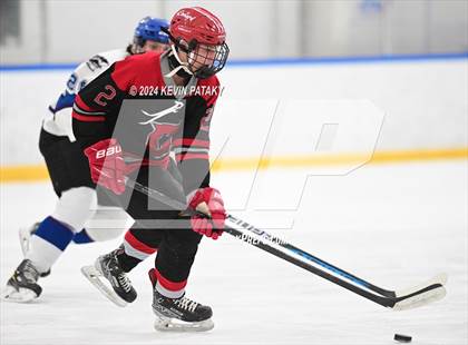 Thumbnail 2 in Conard @ Southington/Coginchaug/Westbrook photogallery.
