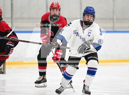 Thumbnail 1 in Conard @ Southington/Coginchaug/Westbrook photogallery.