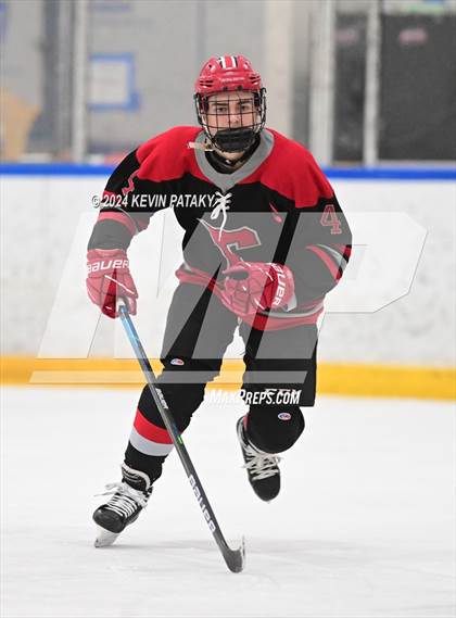 Thumbnail 3 in Conard @ Southington/Coginchaug/Westbrook photogallery.