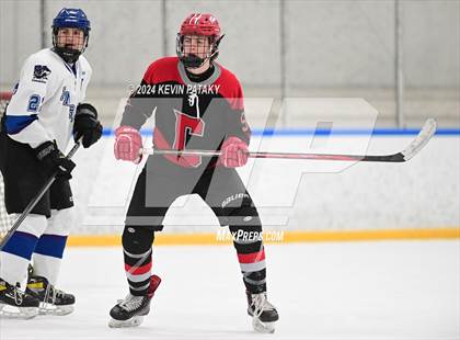 Thumbnail 3 in Conard @ Southington/Coginchaug/Westbrook photogallery.