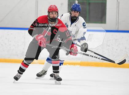Thumbnail 3 in Conard @ Southington/Coginchaug/Westbrook photogallery.
