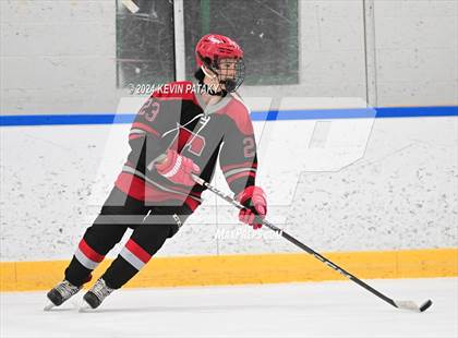 Thumbnail 2 in Conard @ Southington/Coginchaug/Westbrook photogallery.