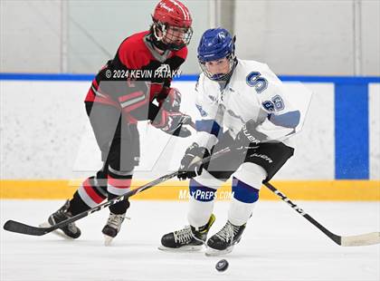 Thumbnail 3 in Conard @ Southington/Coginchaug/Westbrook photogallery.