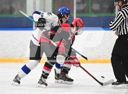 Thumbnail 3 in Conard @ Southington/Coginchaug/Westbrook photogallery.