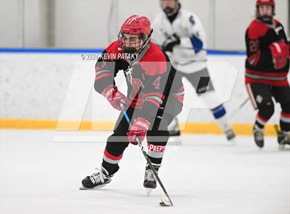 Thumbnail 3 in Conard @ Southington/Coginchaug/Westbrook photogallery.