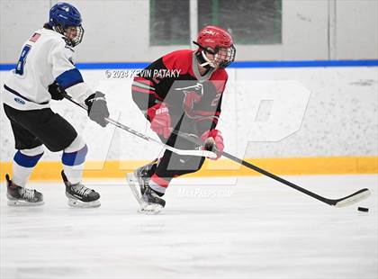 Thumbnail 2 in Conard @ Southington/Coginchaug/Westbrook photogallery.