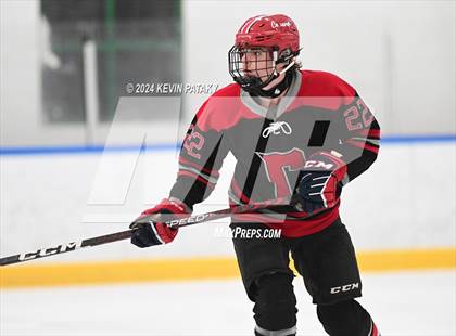Thumbnail 3 in Conard @ Southington/Coginchaug/Westbrook photogallery.