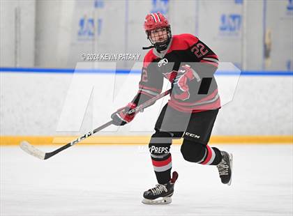 Thumbnail 3 in Conard @ Southington/Coginchaug/Westbrook photogallery.
