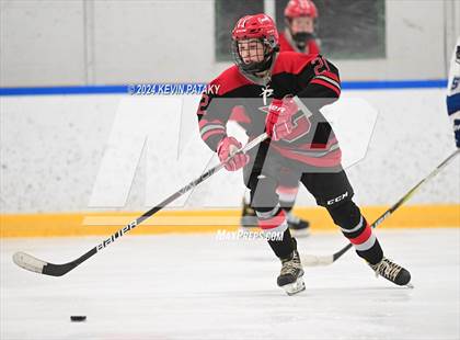 Thumbnail 3 in Conard @ Southington/Coginchaug/Westbrook photogallery.