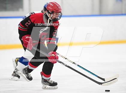 Thumbnail 1 in Conard @ Southington/Coginchaug/Westbrook photogallery.