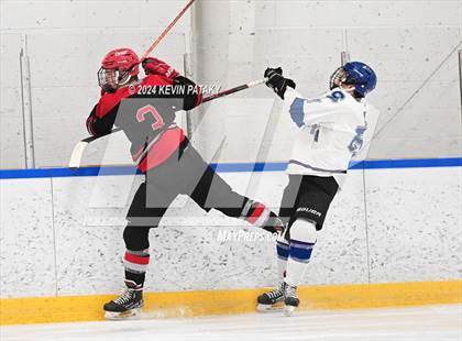 Thumbnail 1 in Conard @ Southington/Coginchaug/Westbrook photogallery.