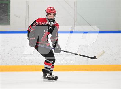 Thumbnail 3 in Conard @ Southington/Coginchaug/Westbrook photogallery.