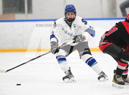 Thumbnail 3 in Conard @ Southington/Coginchaug/Westbrook photogallery.
