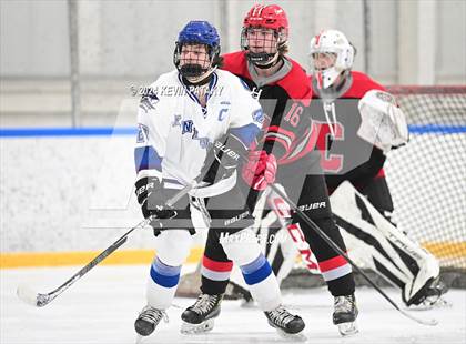 Thumbnail 2 in Conard @ Southington/Coginchaug/Westbrook photogallery.
