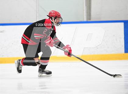 Thumbnail 1 in Conard @ Southington/Coginchaug/Westbrook photogallery.