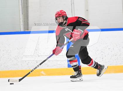 Thumbnail 2 in Conard @ Southington/Coginchaug/Westbrook photogallery.