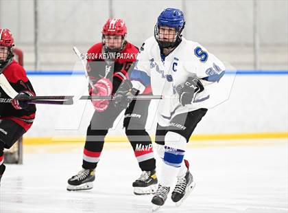 Thumbnail 1 in Conard @ Southington/Coginchaug/Westbrook photogallery.