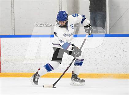 Thumbnail 3 in Conard @ Southington/Coginchaug/Westbrook photogallery.