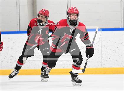 Thumbnail 1 in Conard @ Southington/Coginchaug/Westbrook photogallery.