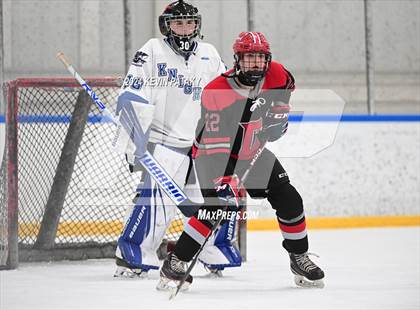 Thumbnail 3 in Conard @ Southington/Coginchaug/Westbrook photogallery.