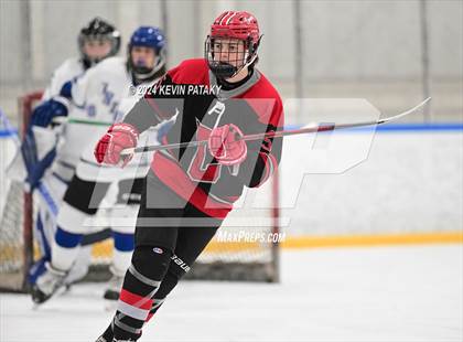 Thumbnail 1 in Conard @ Southington/Coginchaug/Westbrook photogallery.