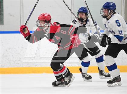 Thumbnail 3 in Conard @ Southington/Coginchaug/Westbrook photogallery.