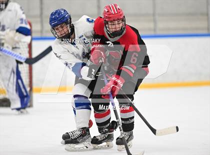 Thumbnail 2 in Conard @ Southington/Coginchaug/Westbrook photogallery.