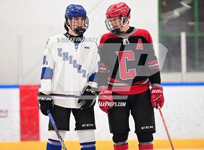 Thumbnail 1 in Conard @ Southington/Coginchaug/Westbrook photogallery.