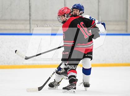 Thumbnail 3 in Conard @ Southington/Coginchaug/Westbrook photogallery.