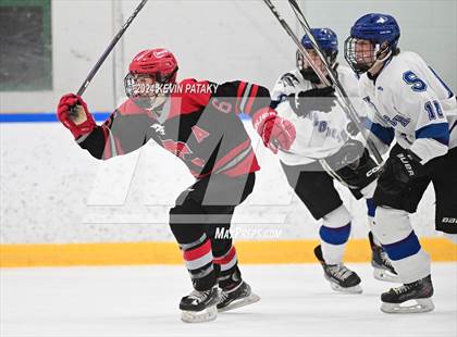 Thumbnail 1 in Conard @ Southington/Coginchaug/Westbrook photogallery.