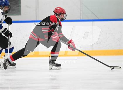 Thumbnail 3 in Conard @ Southington/Coginchaug/Westbrook photogallery.
