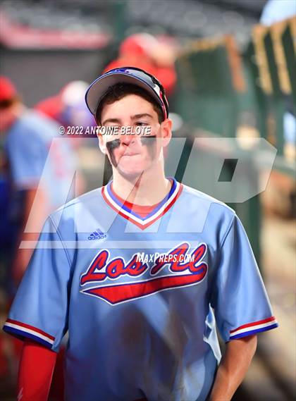 Thumbnail 2 in Esperanza vs. Los Alamitos photogallery.