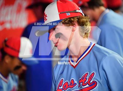Thumbnail 3 in Esperanza vs. Los Alamitos photogallery.