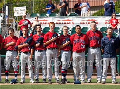 Thumbnail 1 in Buhach Colony vs. Beyer (CIF SJS D1 Playoffs) photogallery.