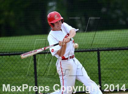 Thumbnail 1 in Cherry Hill East @ Lenape photogallery.