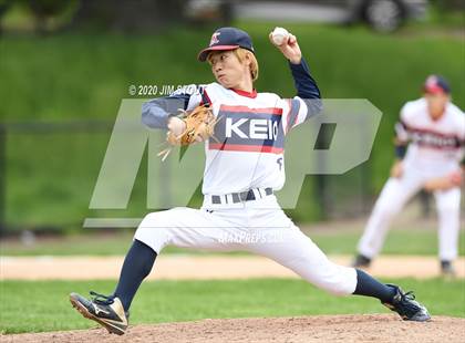 Thumbnail 3 in Keio Academy Baseball (Extending the Season) photogallery.