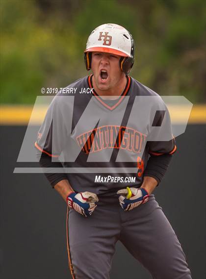 Thumbnail 2 in Huntington Beach vs. Aliso Niguel photogallery.