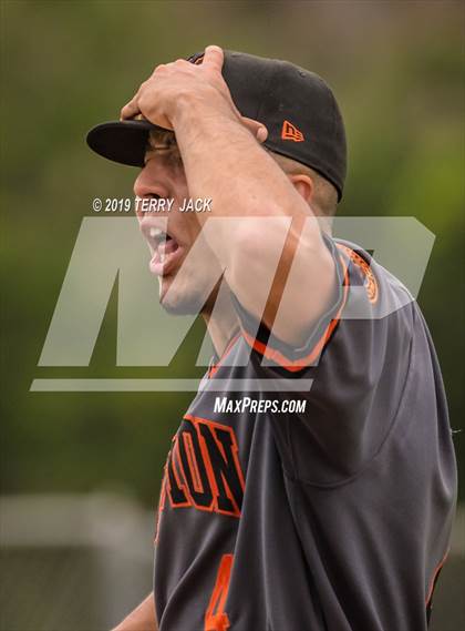 Thumbnail 2 in Huntington Beach vs. Aliso Niguel photogallery.