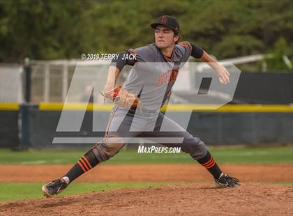 Thumbnail 3 in Huntington Beach vs. Aliso Niguel photogallery.